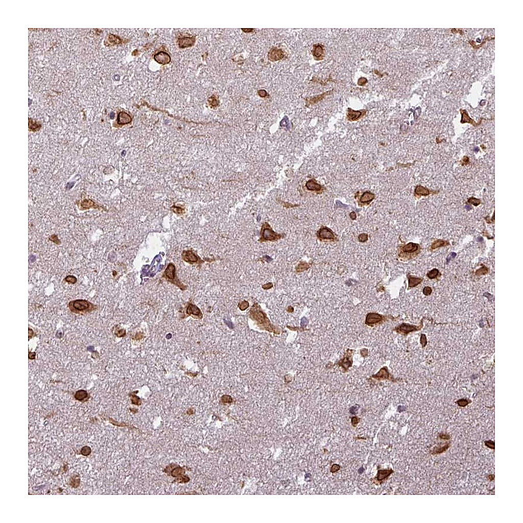 Atlas Antibodies Anti-COX18 Antibody