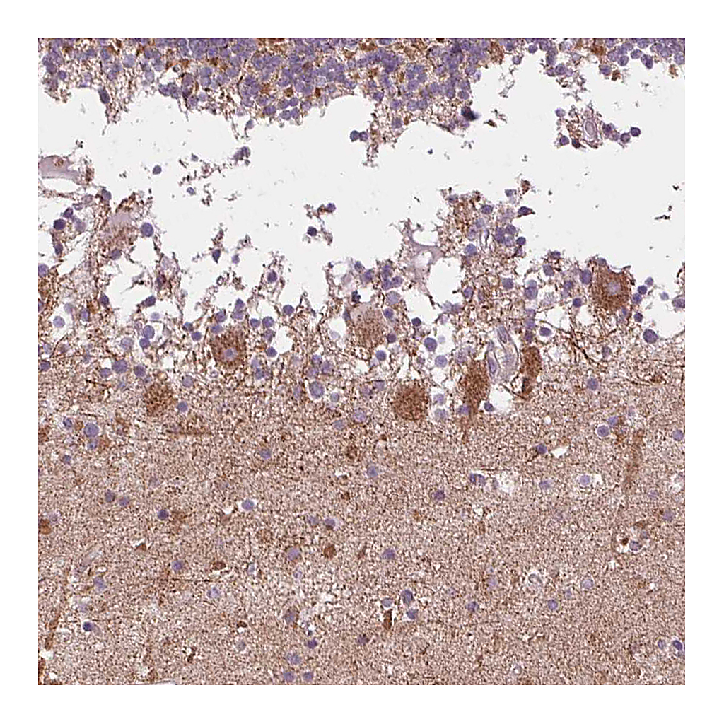 Atlas Antibodies Anti-COX6A1 Antibody
