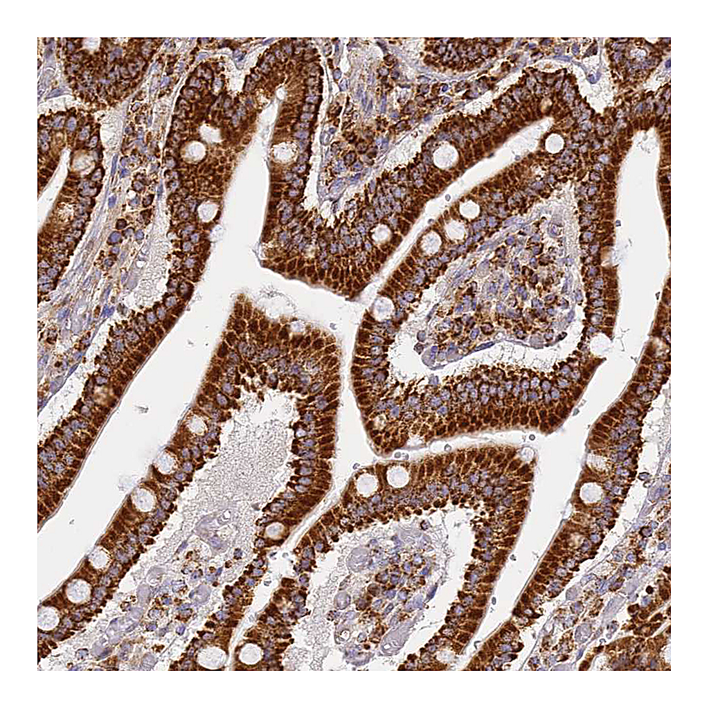 Atlas Antibodies Anti-COX6C Antibody