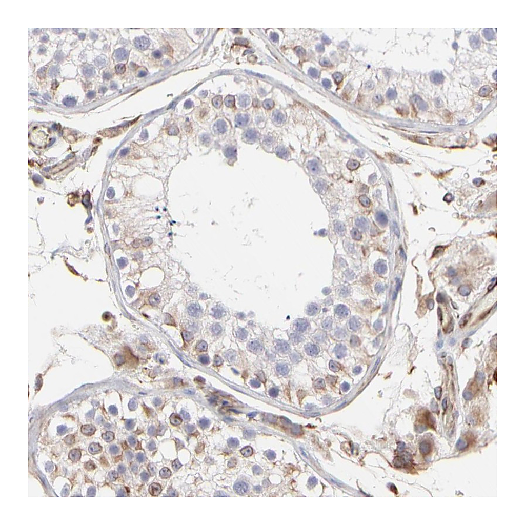 Atlas Antibodies Anti-COX8C Antibody