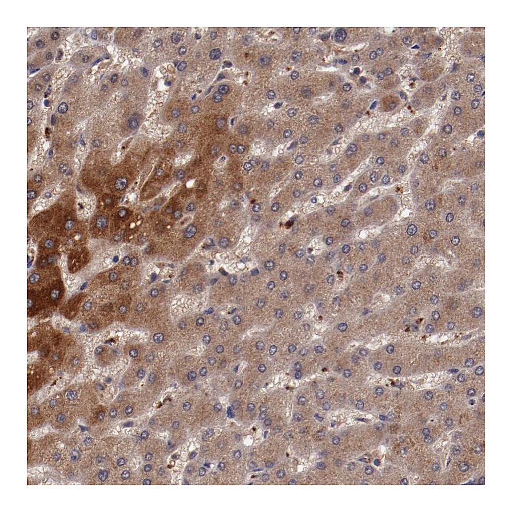 Atlas Antibodies Anti-CP Antibody