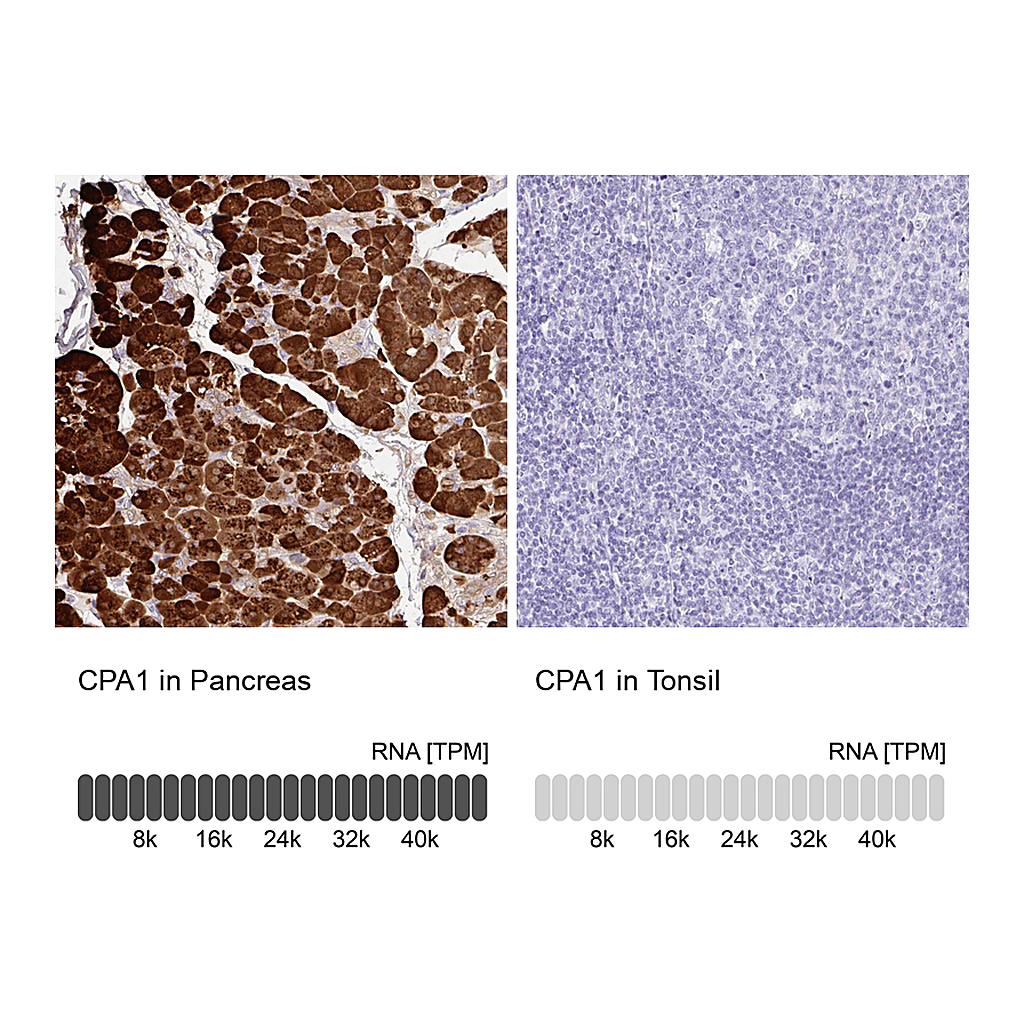 Atlas Antibodies Anti-CPA1 Antibody