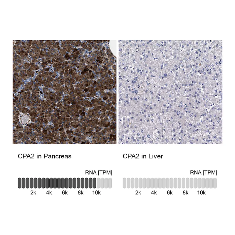 Atlas Antibodies Anti-CPA2 Antibody