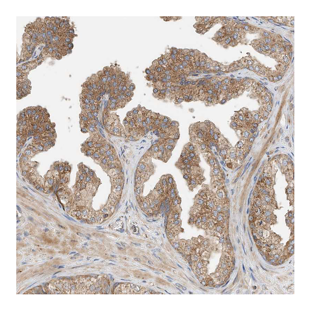 Atlas Antibodies Anti-CPAMD8 Antibody