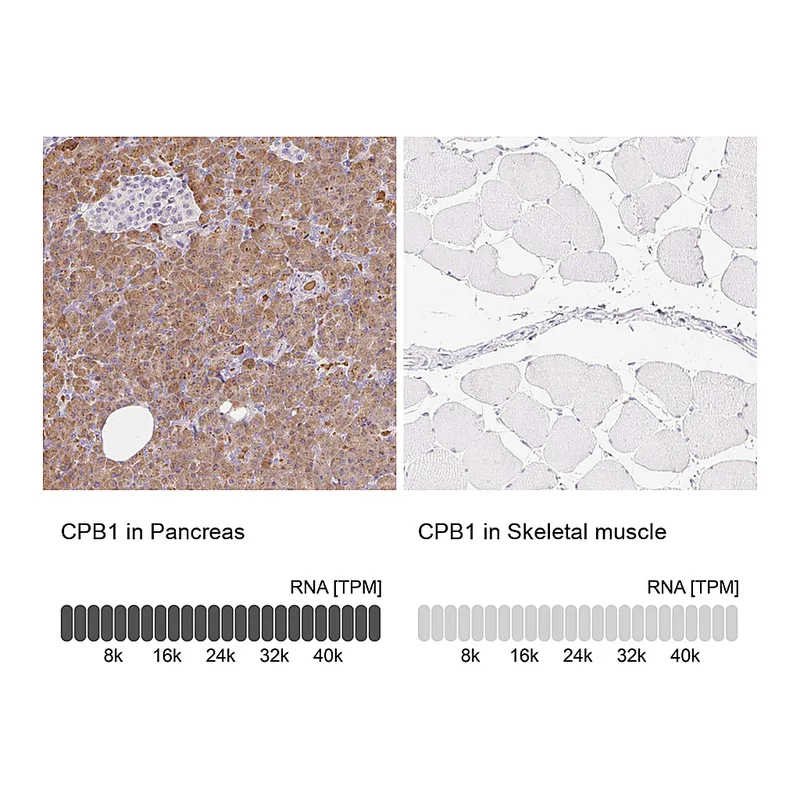 Atlas Antibodies Anti-CPB1 Antibody