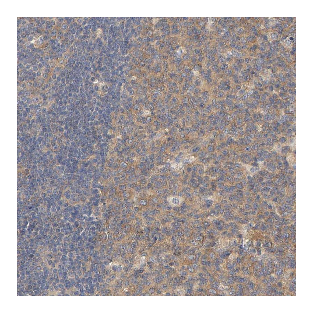 Atlas Antibodies Anti-CPB2 Antibody