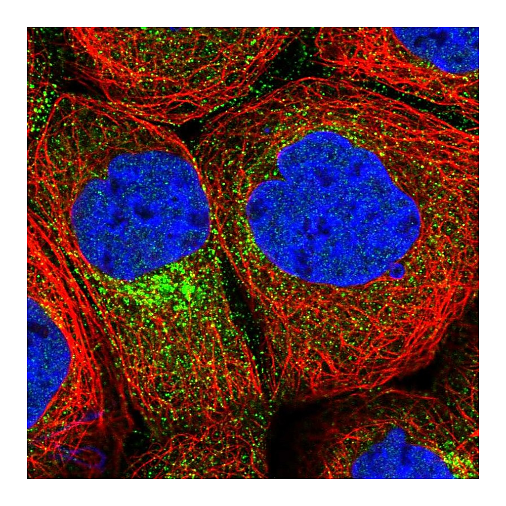 Atlas Antibodies Anti-CPEB4 Antibody