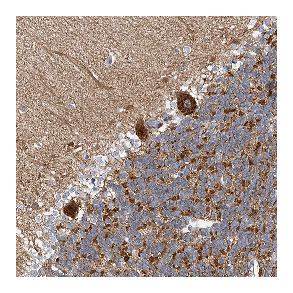 Atlas Antibodies Anti-CPNE6 Antibody