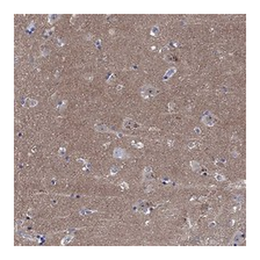 Atlas Antibodies Anti-CPNE6 Antibody