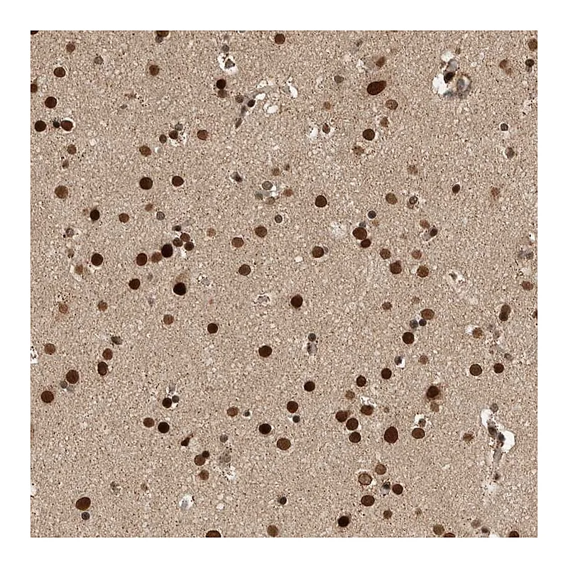 Atlas Antibodies Anti-CPSF2 Antibody