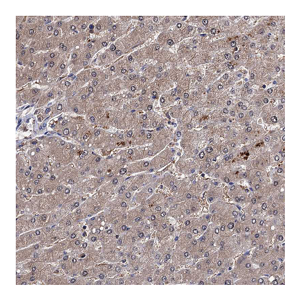 Atlas Antibodies Anti-CPPED1 Antibody
