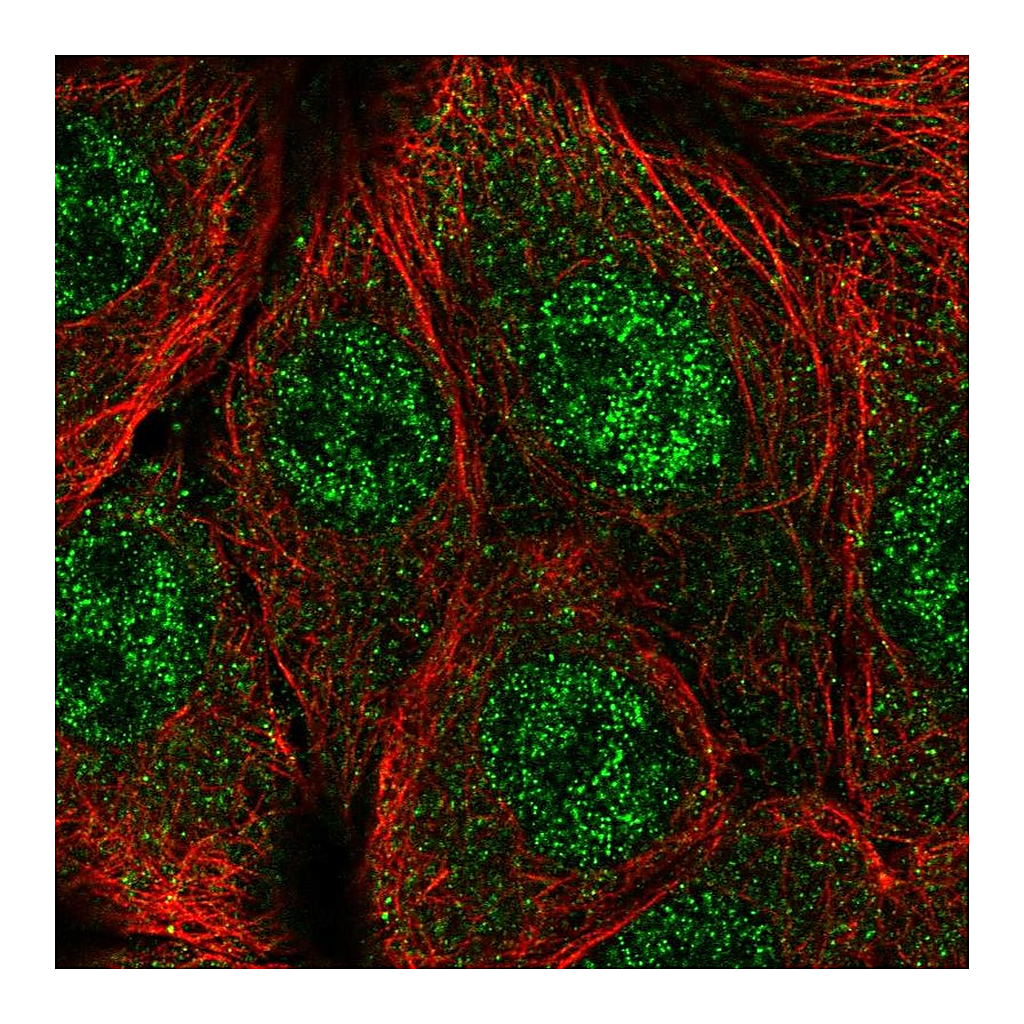 Atlas Antibodies Anti-CPSF1 Antibody