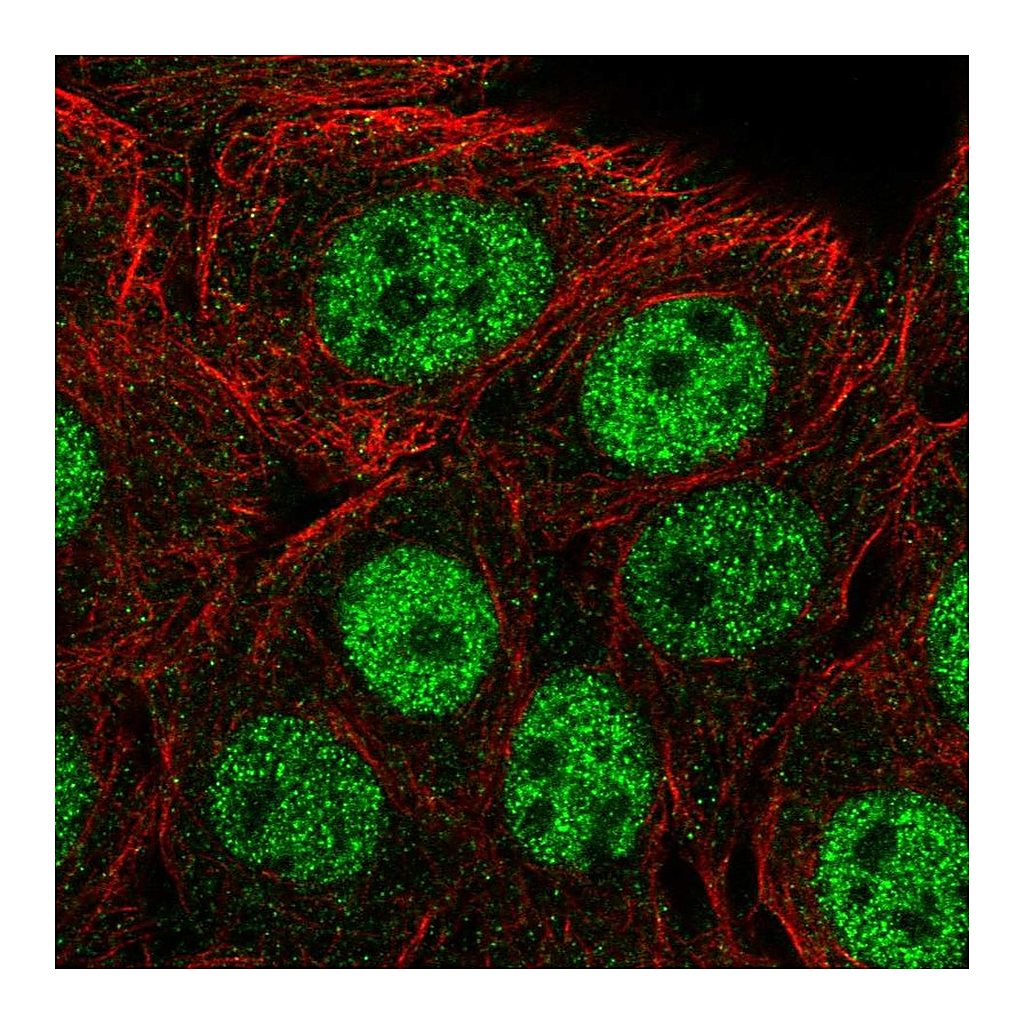 Atlas Antibodies Anti-CPSF1 Antibody
