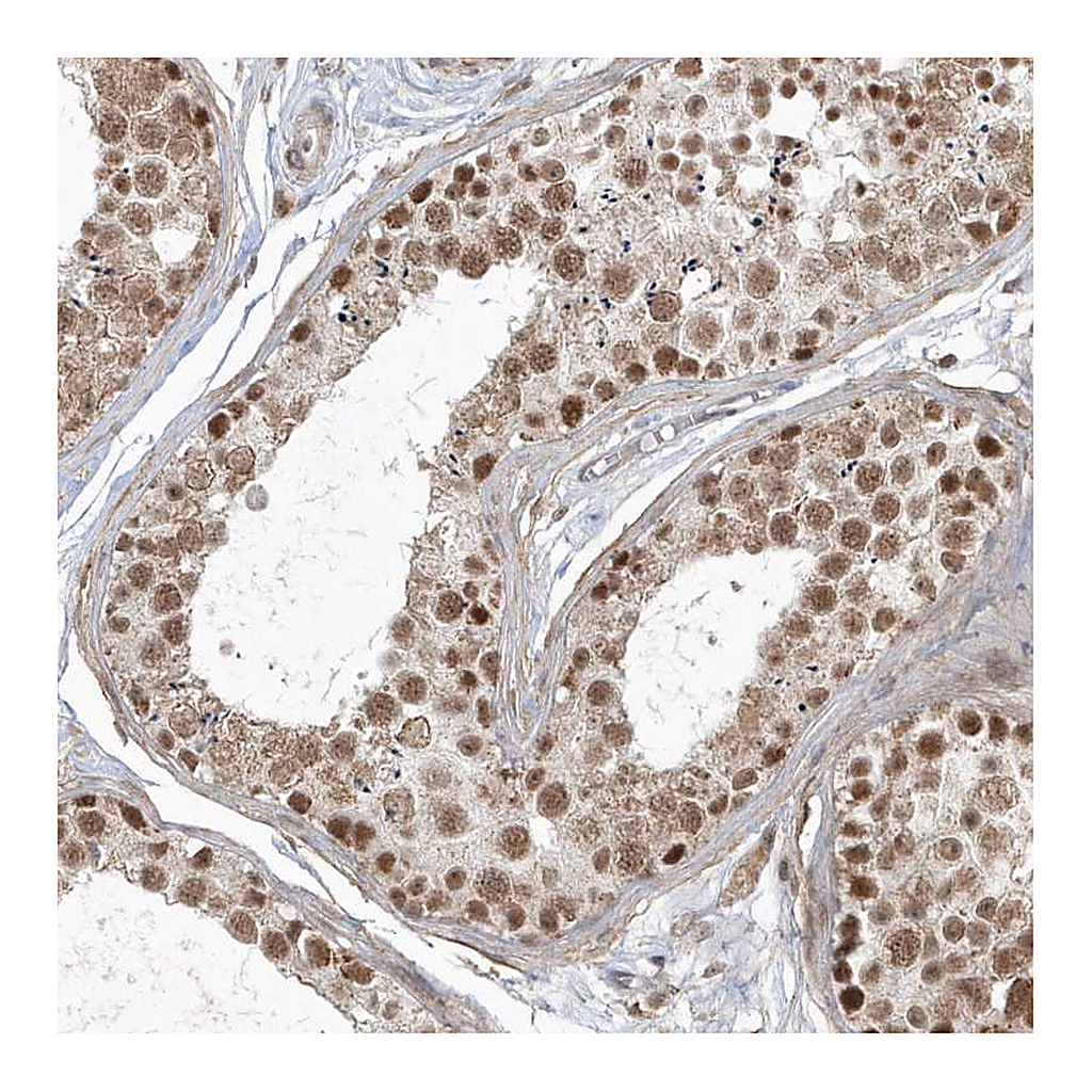 Atlas Antibodies Anti-CPSF3 Antibody