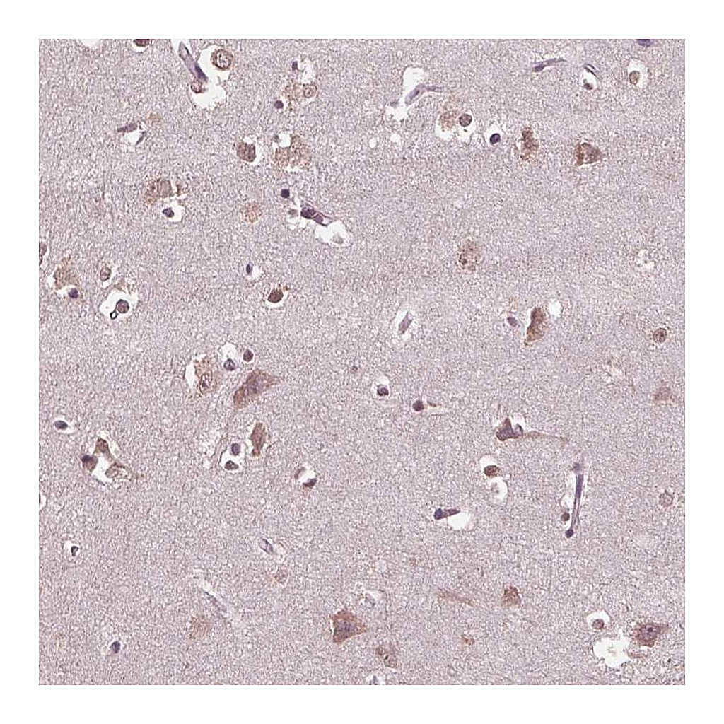 Atlas Antibodies Anti-CPT1C Antibody