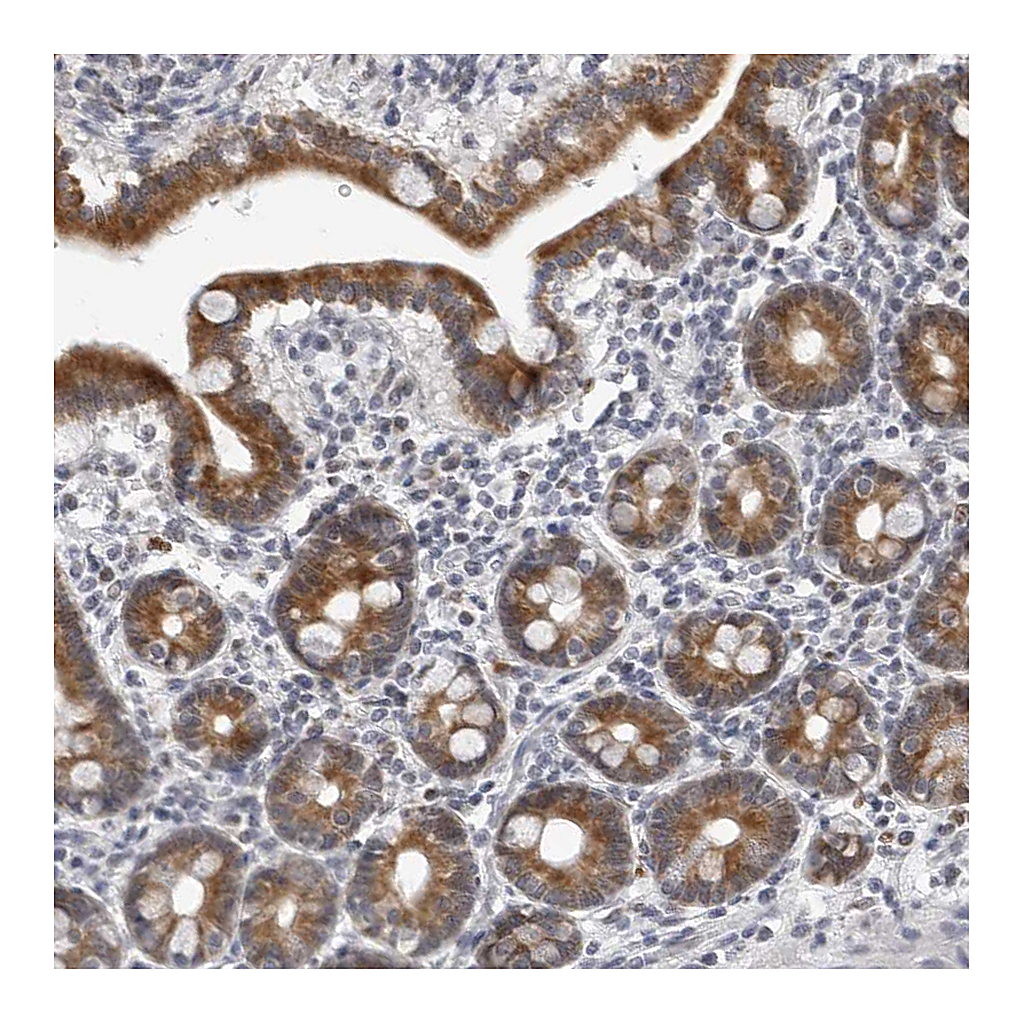 Atlas Antibodies Anti-CPT2 Antibody