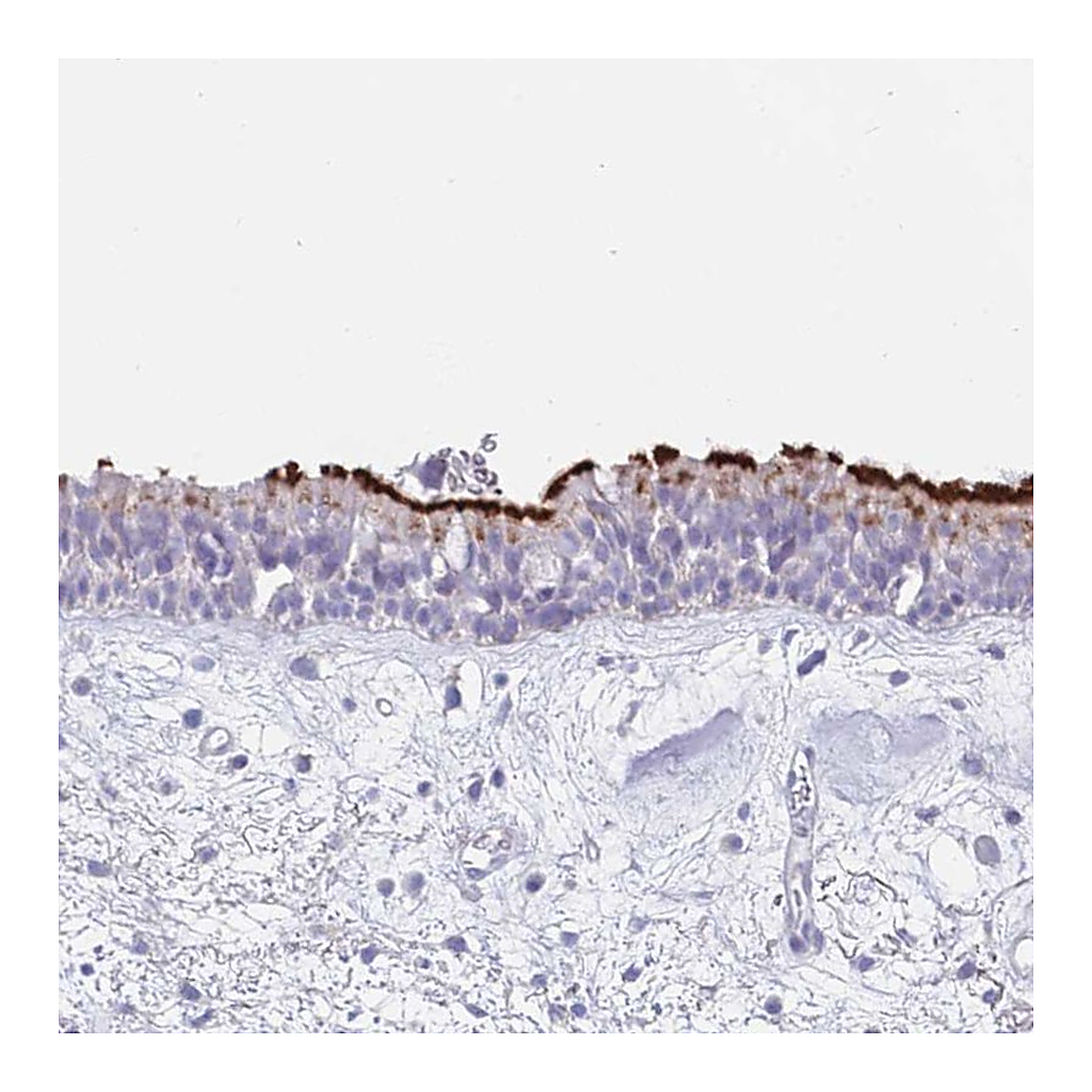 Atlas Antibodies Anti-CPXM2 Antibody