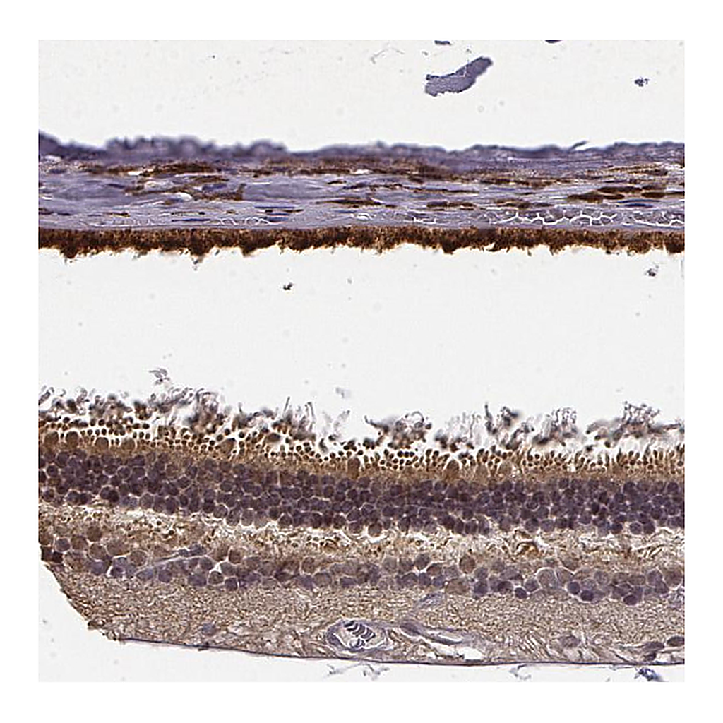 Atlas Antibodies Anti-CRB1 Antibody