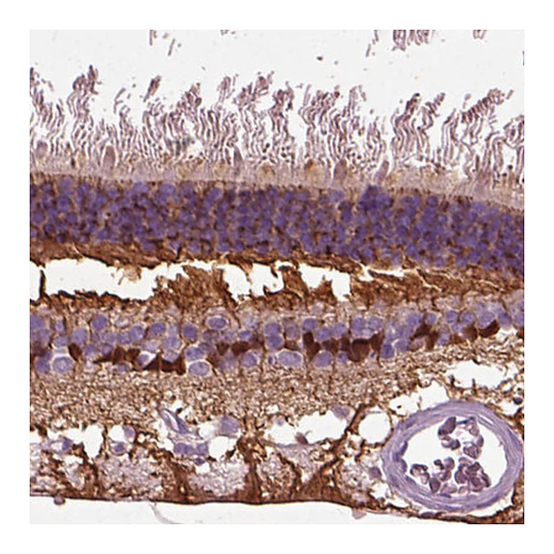 Atlas Antibodies Anti-CRABP1 Antibody