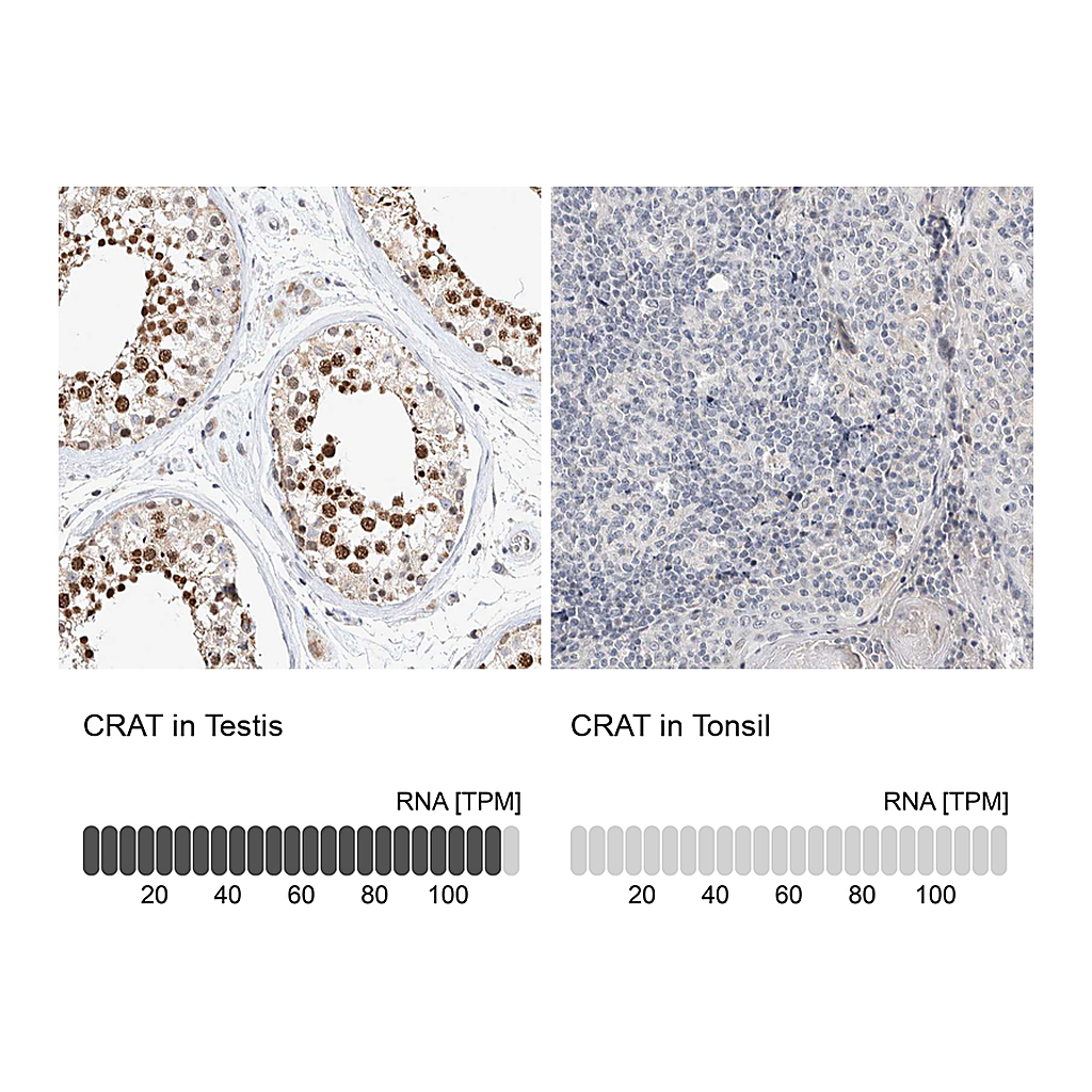 Atlas Antibodies Anti-CRAT Antibody