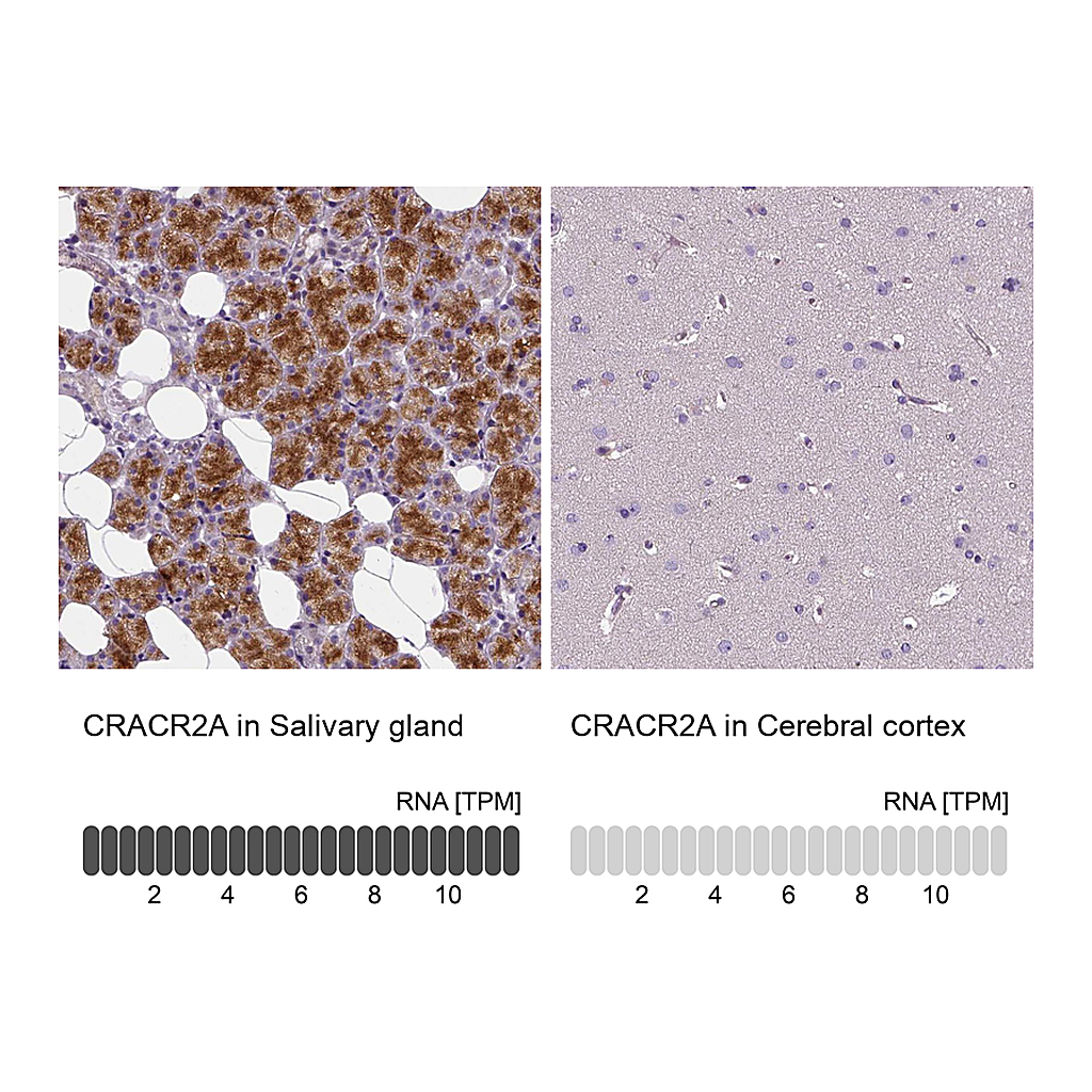 Atlas Antibodies Anti-CRACR2A Antibody