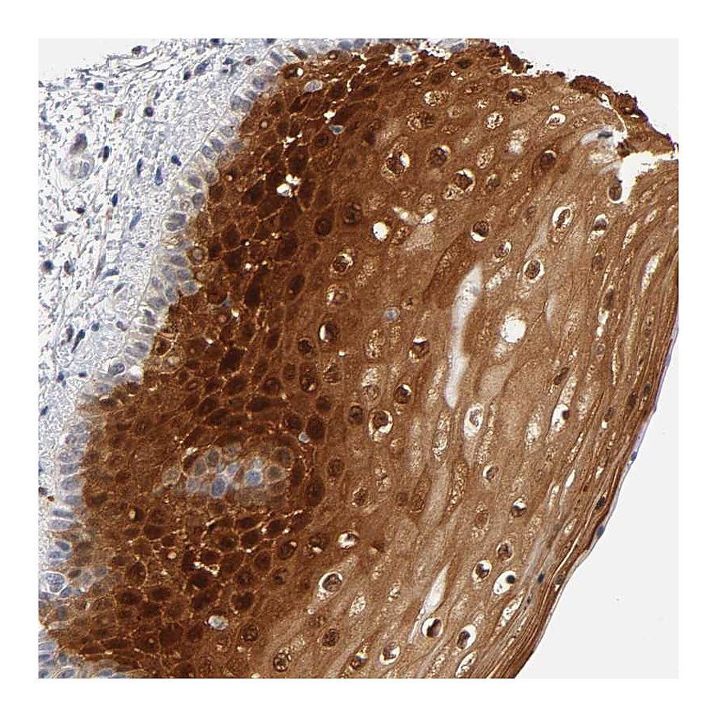 Atlas Antibodies Anti-CRABP2 Antibody