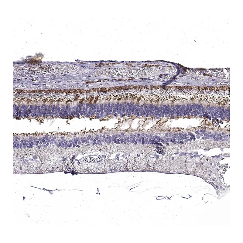 Atlas Antibodies Anti-CRB1 Antibody