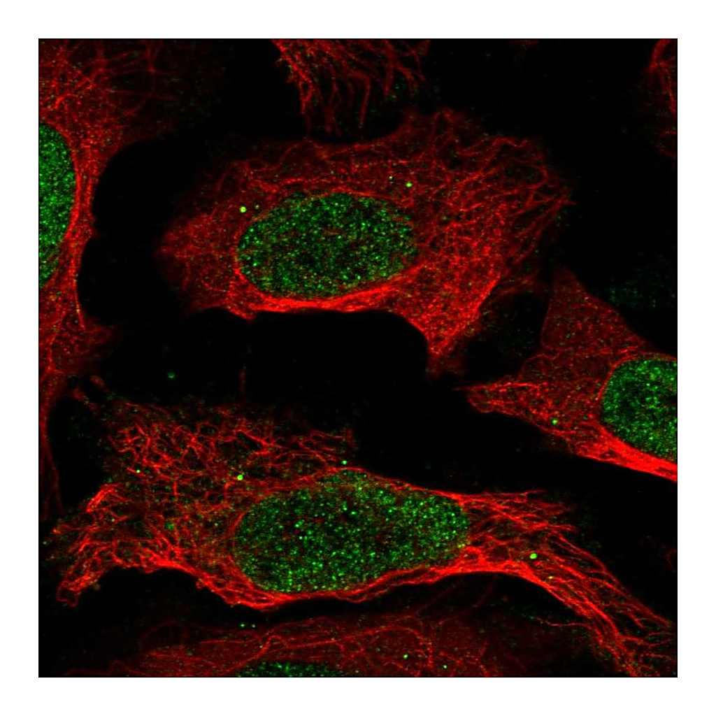 Atlas Antibodies Anti-CREB5 Antibody