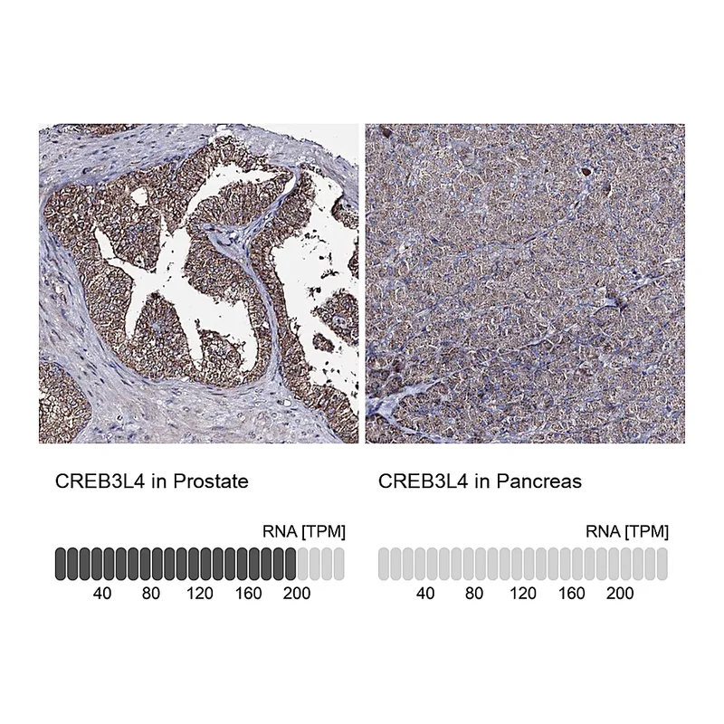 Atlas Antibodies Anti-CREB3L4 Antibody