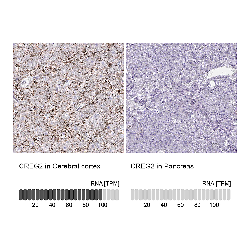 Atlas Antibodies Anti-CREG2 Antibody