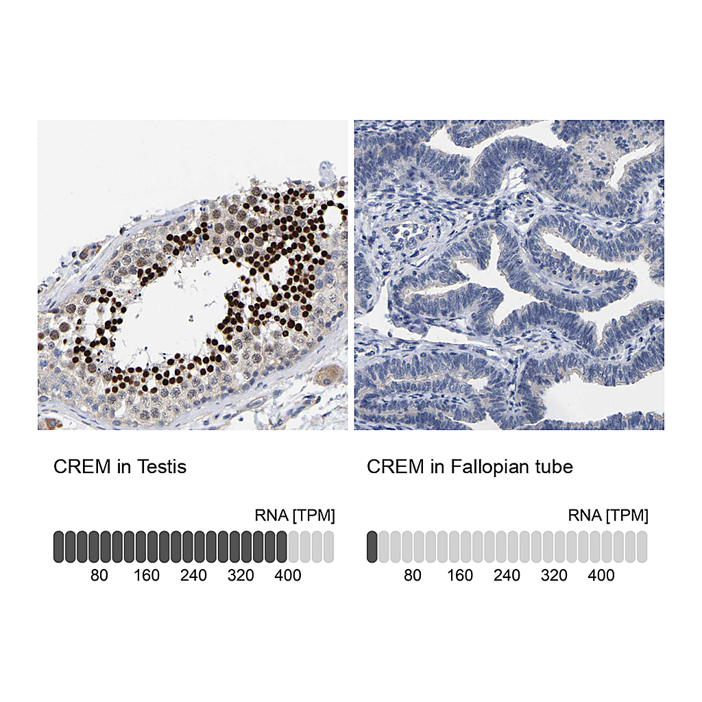 Atlas Antibodies Anti-CREM Antibody