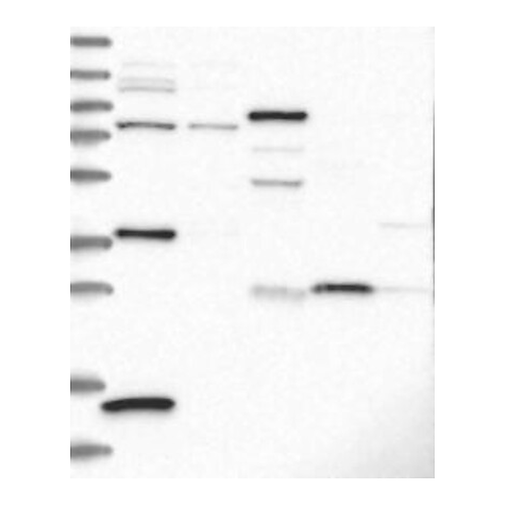 Atlas Antibodies Anti-CRHBP Antibody