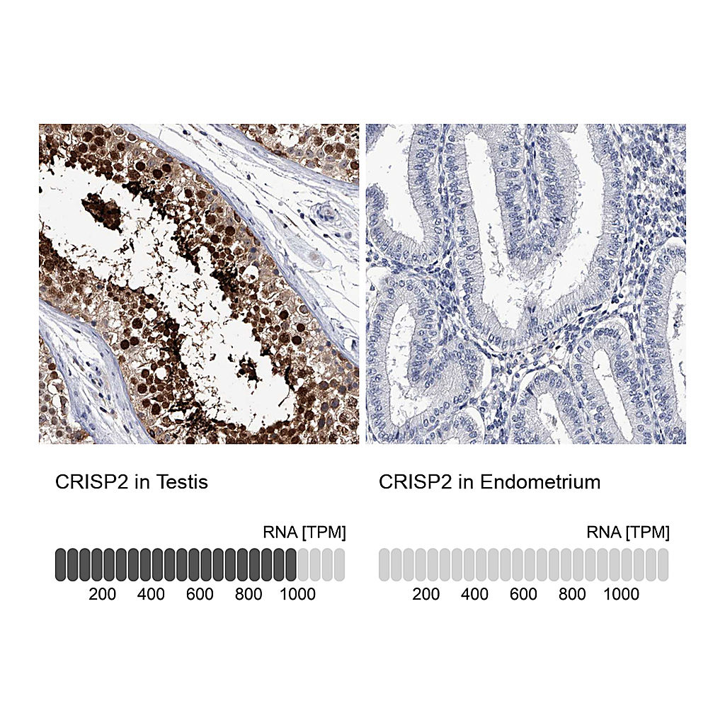 Atlas Antibodies Anti-CRISP2 Antibody