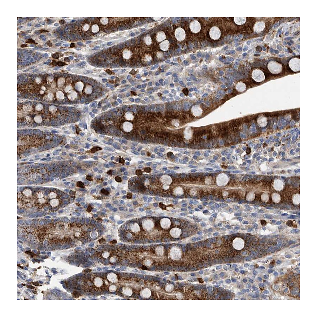 Atlas Antibodies Anti-CRISPLD2 Antibody