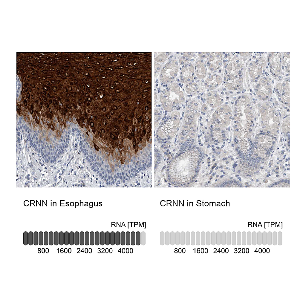 Atlas Antibodies Anti-CRNN Antibody