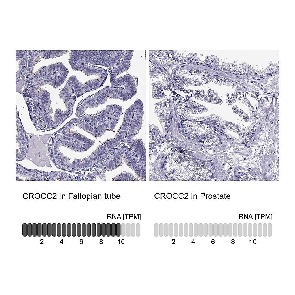 Atlas Antibodies Anti-CROCC2 Antibody