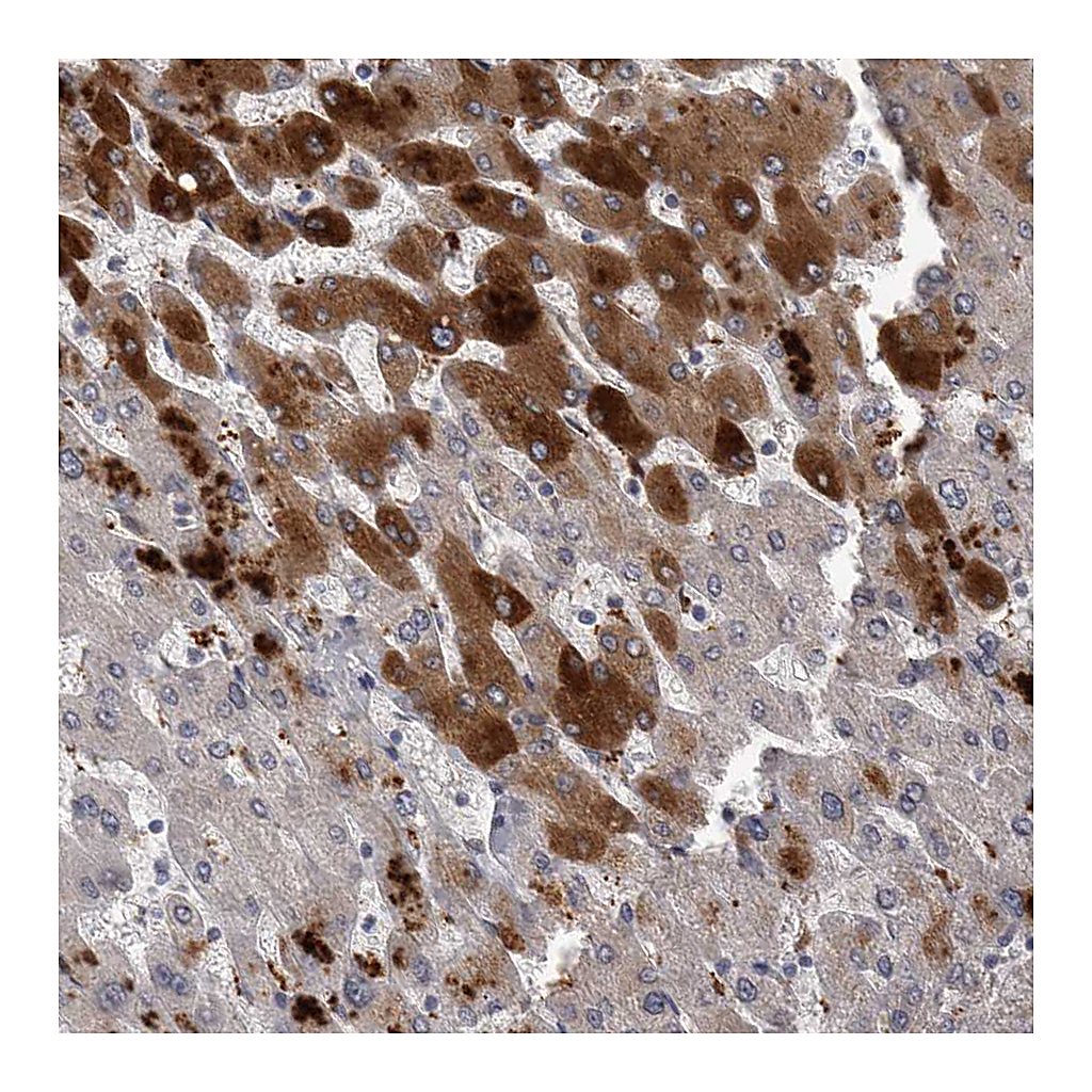 Atlas Antibodies Anti-CRP Antibody