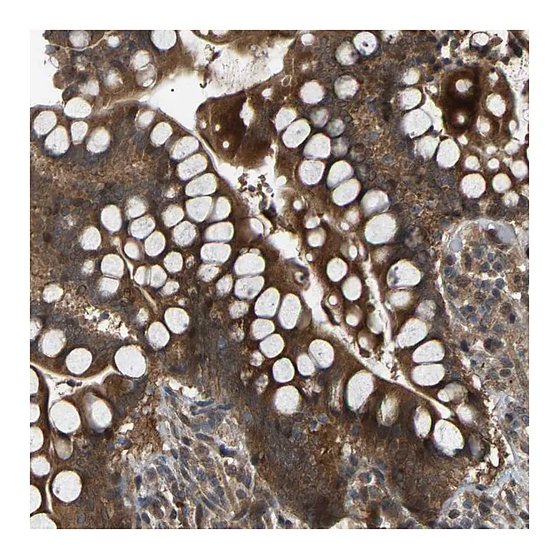 Atlas Antibodies Anti-CROT Antibody