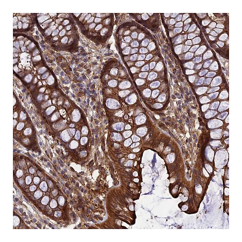 Atlas Antibodies Anti-CRTAP Antibody