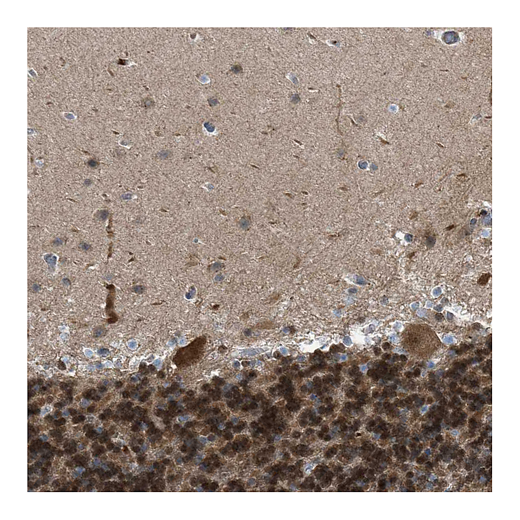 Atlas Antibodies Anti-CRTC1 Antibody