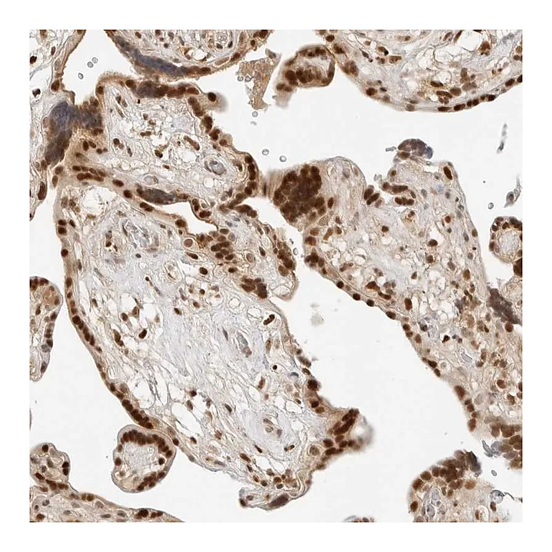 Atlas Antibodies Anti-CRTC2 Antibody
