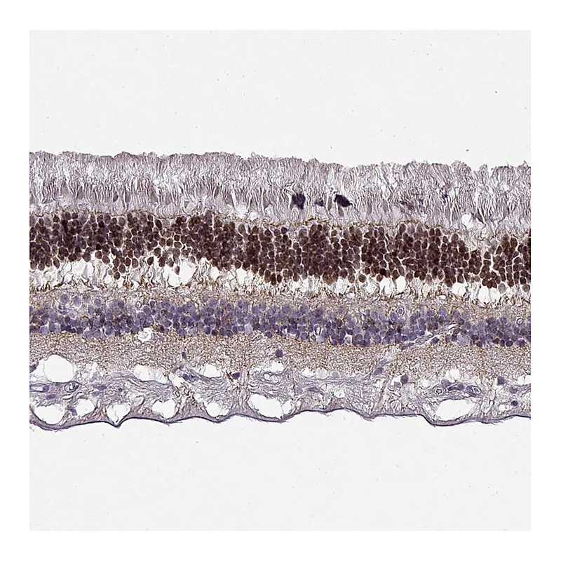 Atlas Antibodies Anti-CRX Antibody