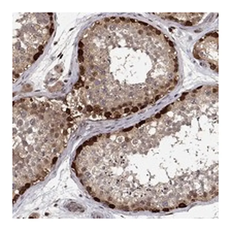 Atlas Antibodies Anti-CRTC1 Antibody