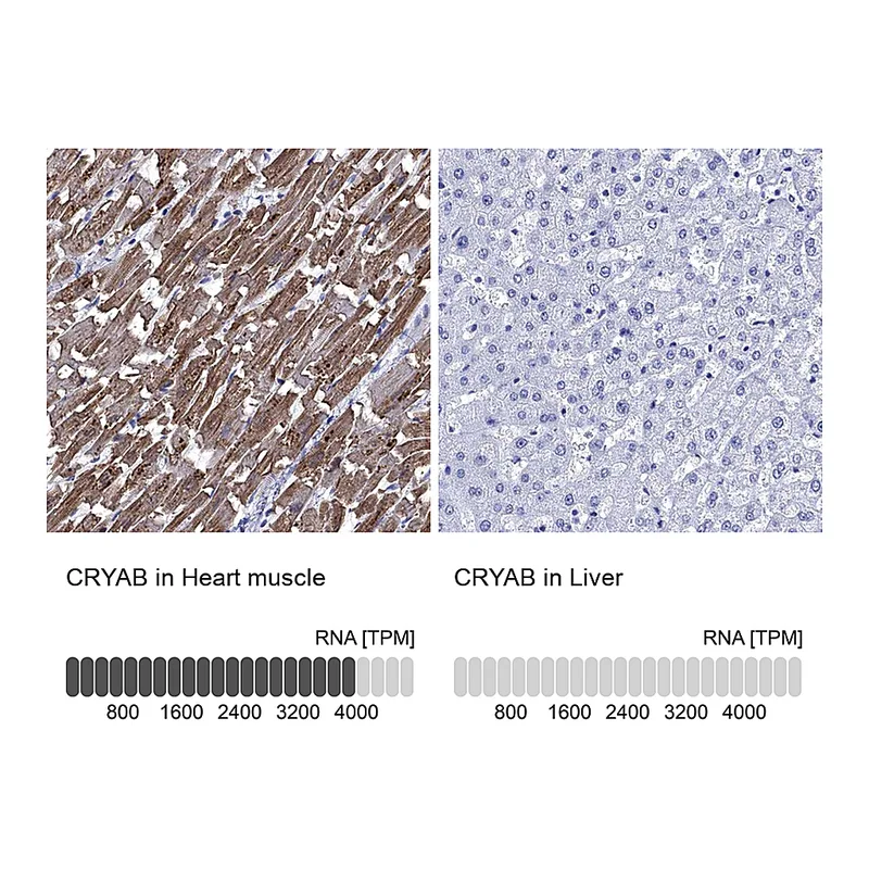Atlas Antibodies Anti-CRYAB Antibody