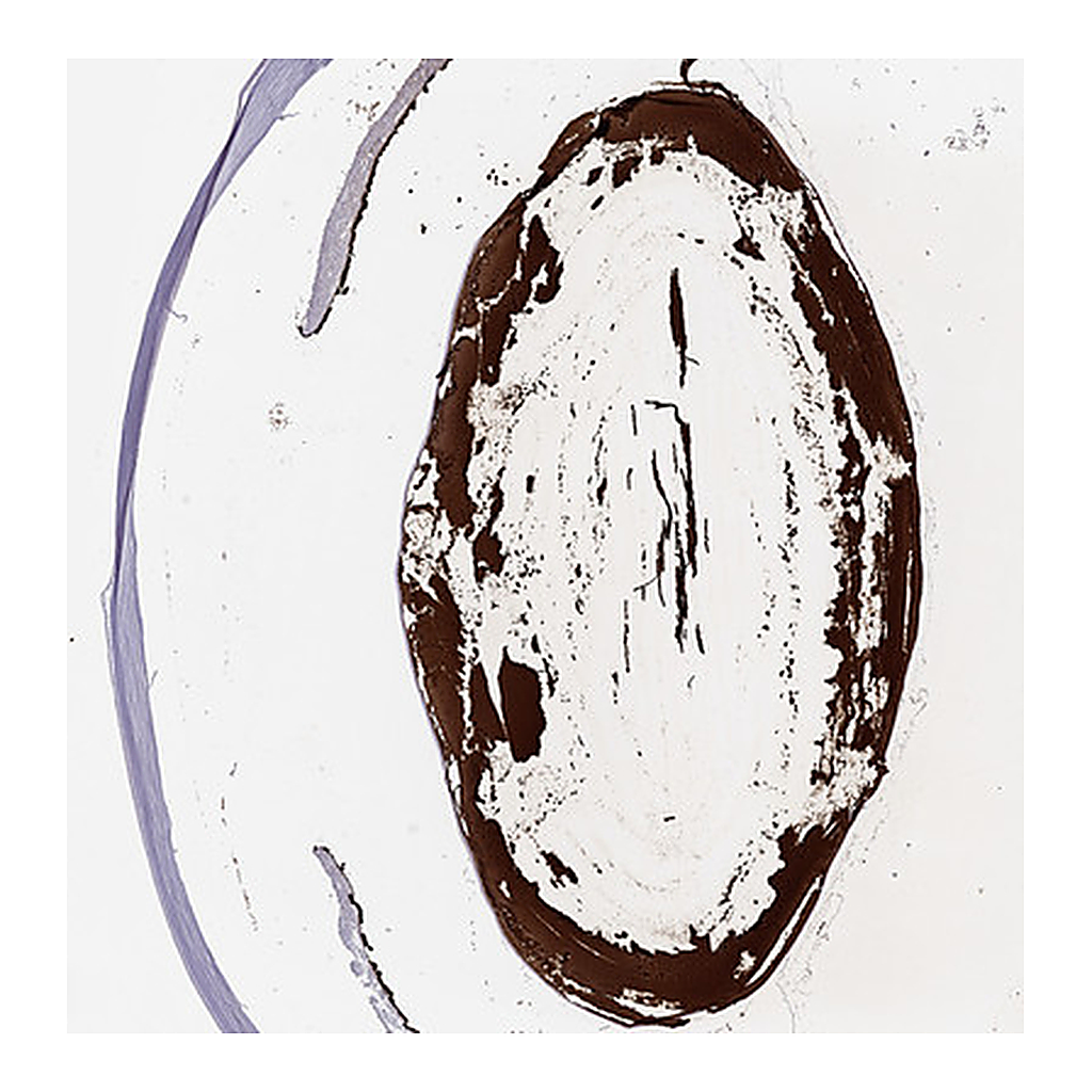 Atlas Antibodies Anti-CRYBB1 Antibody