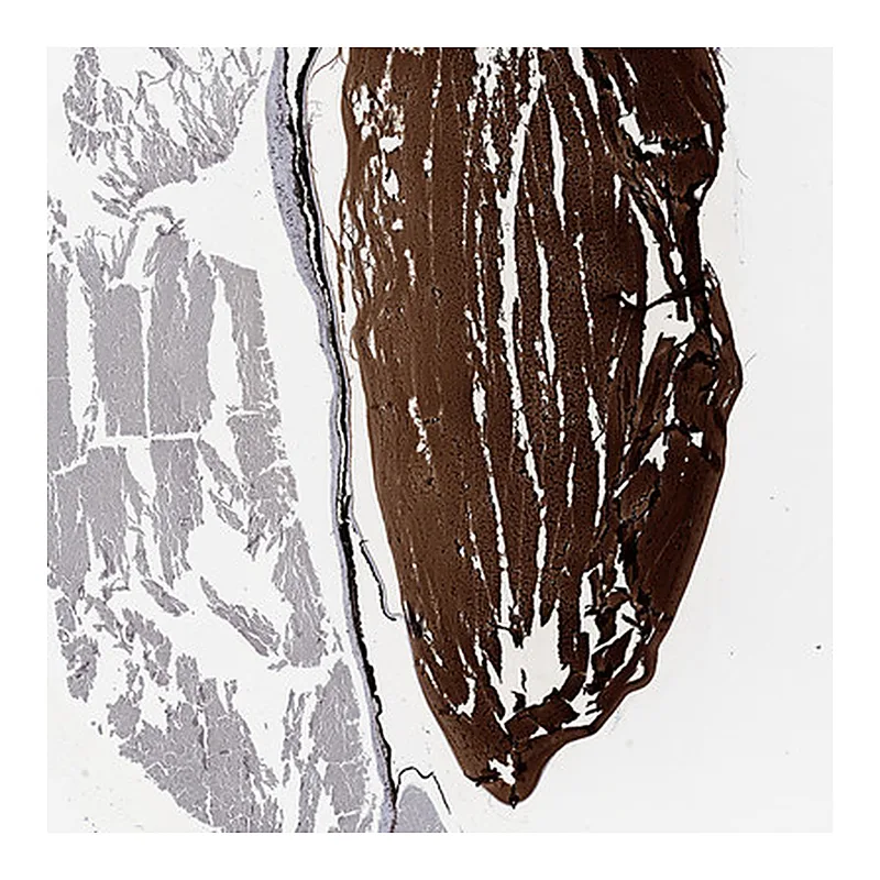 Atlas Antibodies Anti-CRYGA Antibody