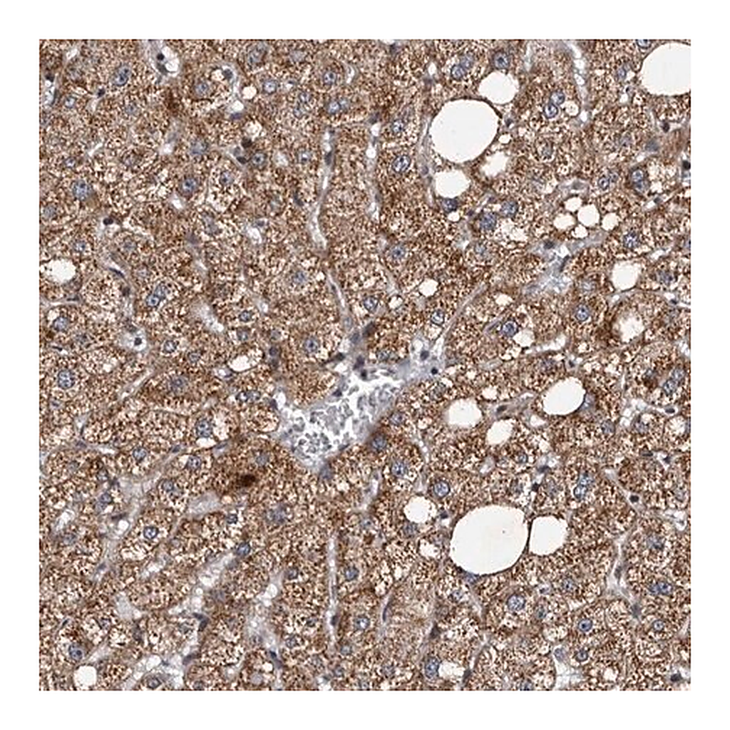 Merck Anti-TNKS antibody produced in rabbit