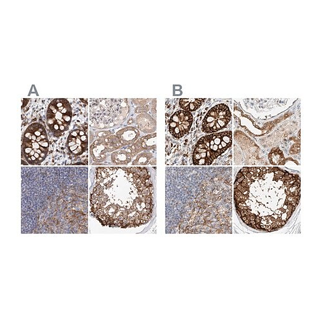 Merck Anti-CARMIL1 antibody produced in rabbit