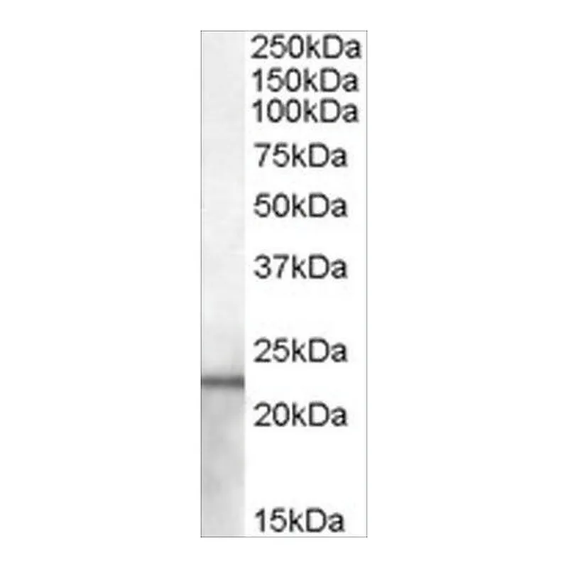 Merck Anti-Lipocalin 2/NGAL (AB2) antibody produced in goat