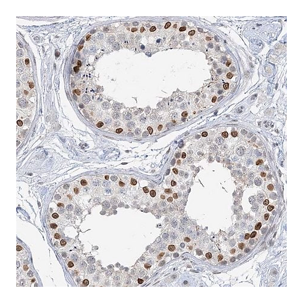 Merck Anti-KMT2D antibody produced in rabbit